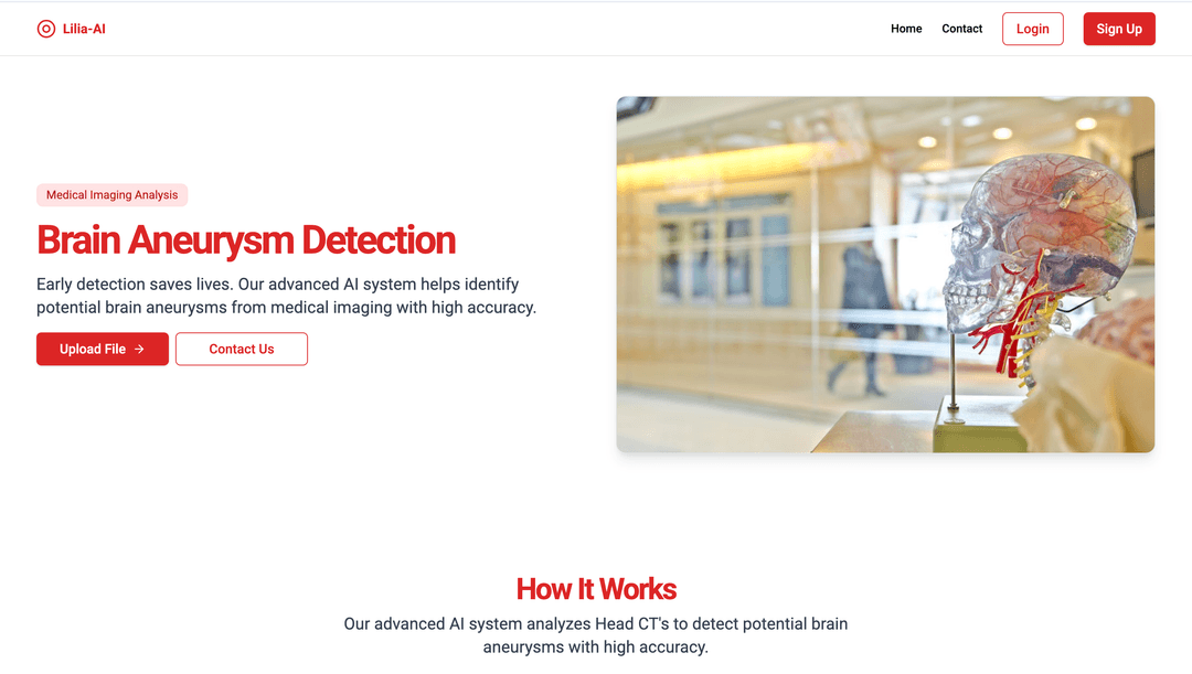Lilia-Al - Brain Aneurysm Detection